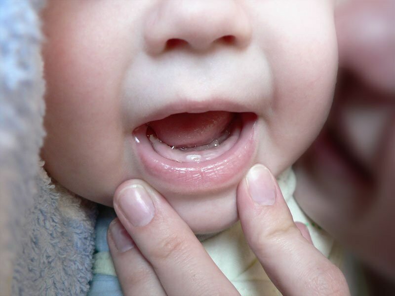 Как облегчить боль при прорезывании зубов у детей? – 4 лучших способа