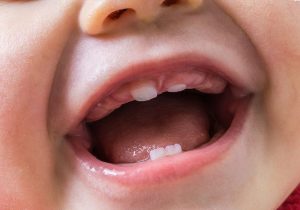 Во сколько прорезаются зубы? Какие появляются первыми? Насколько это больно? – Все о первых зубах ребенка